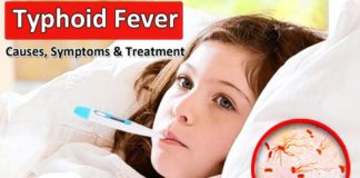typhoid fever symptoms and treatment